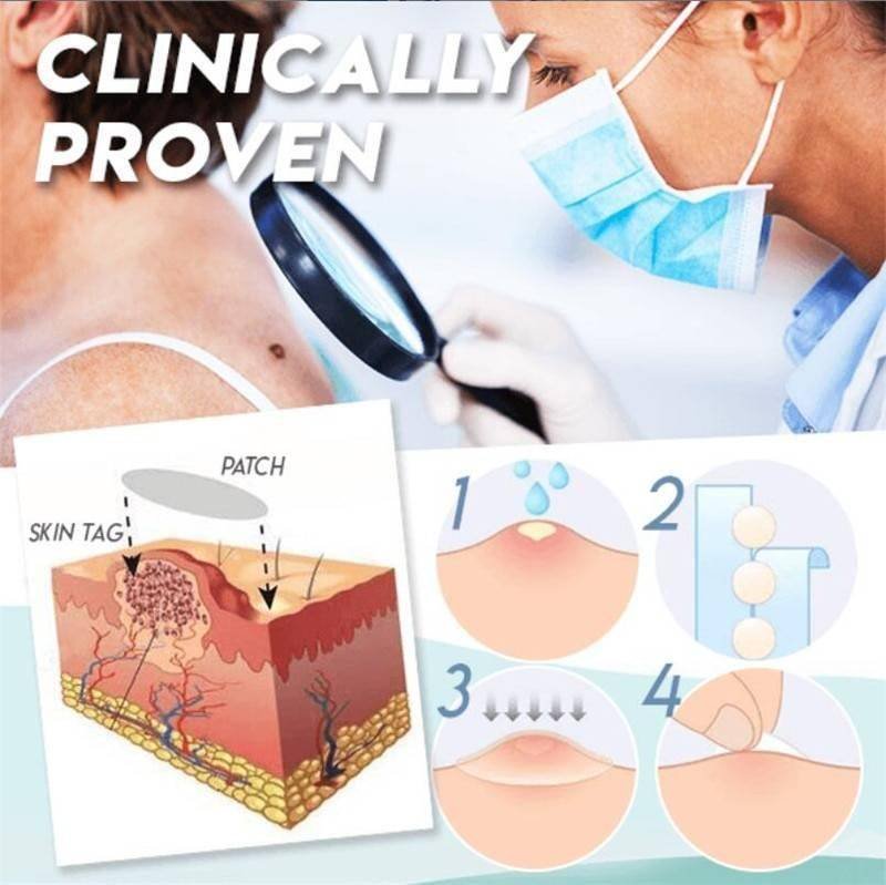Skin Tag Remover Patch Ance Pimple Patch Plaster Acne Cream Hydrocolloid Master Anti-infection Quick Absorb Face Care Beauty & Health Best Sellers Skin Tag Remover Patch Ance Pimple Patch Plaster Acne Cream Hydrocolloid Master Anti-infection Quick Absorb Face Care Beauty & Health Best Sellers http://gotoptrend.com/skin-tag-remover-patch-ance-pimple-patch/ http://gotoptrend.com Go Top Trend