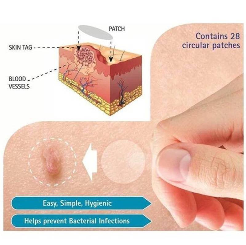 Skin Tag Remover Patch Ance Pimple Patch Plaster Acne Cream Hydrocolloid Master Anti-infection Quick Absorb Face Care Beauty & Health Best Sellers Skin Tag Remover Patch Ance Pimple Patch Plaster Acne Cream Hydrocolloid Master Anti-infection Quick Absorb Face Care Beauty & Health Best Sellers http://gotoptrend.com/skin-tag-remover-patch-ance-pimple-patch/ http://gotoptrend.com Go Top Trend