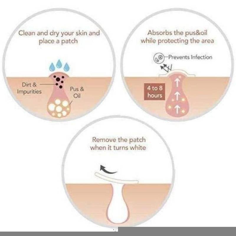 Skin Tag Remover Patch Ance Pimple Patch Plaster Acne Cream Hydrocolloid Master Anti-infection Quick Absorb Face Care Beauty & Health Best Sellers Skin Tag Remover Patch Ance Pimple Patch Plaster Acne Cream Hydrocolloid Master Anti-infection Quick Absorb Face Care Beauty & Health Best Sellers http://gotoptrend.com/skin-tag-remover-patch-ance-pimple-patch/ http://gotoptrend.com Go Top Trend