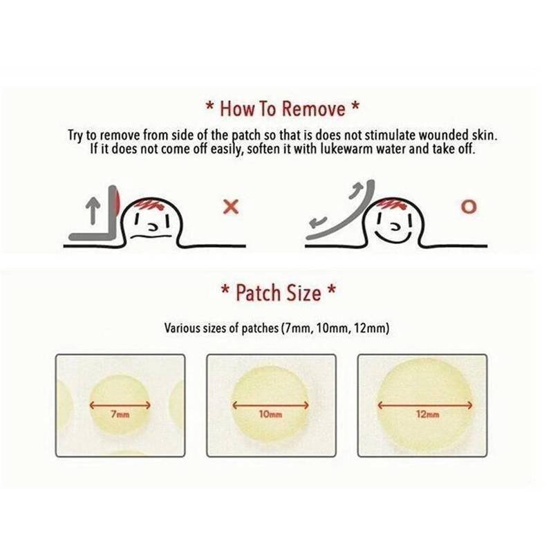 Skin Tag Remover Patch Ance Pimple Patch Plaster Acne Cream Hydrocolloid Master Anti-infection Quick Absorb Face Care Beauty & Health Best Sellers Skin Tag Remover Patch Ance Pimple Patch Plaster Acne Cream Hydrocolloid Master Anti-infection Quick Absorb Face Care Beauty & Health Best Sellers http://gotoptrend.com/skin-tag-remover-patch-ance-pimple-patch/ http://gotoptrend.com Go Top Trend