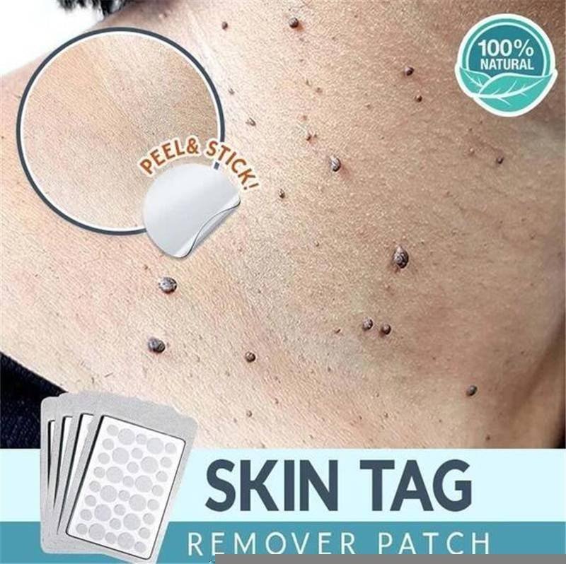 Skin Tag Remover Patch Ance Pimple Patch Plaster Acne Cream Hydrocolloid Master Anti-infection Quick Absorb Face Care Beauty & Health Best Sellers Skin Tag Remover Patch Ance Pimple Patch Plaster Acne Cream Hydrocolloid Master Anti-infection Quick Absorb Face Care Beauty & Health Best Sellers http://gotoptrend.com/skin-tag-remover-patch-ance-pimple-patch/ http://gotoptrend.com Go Top Trend