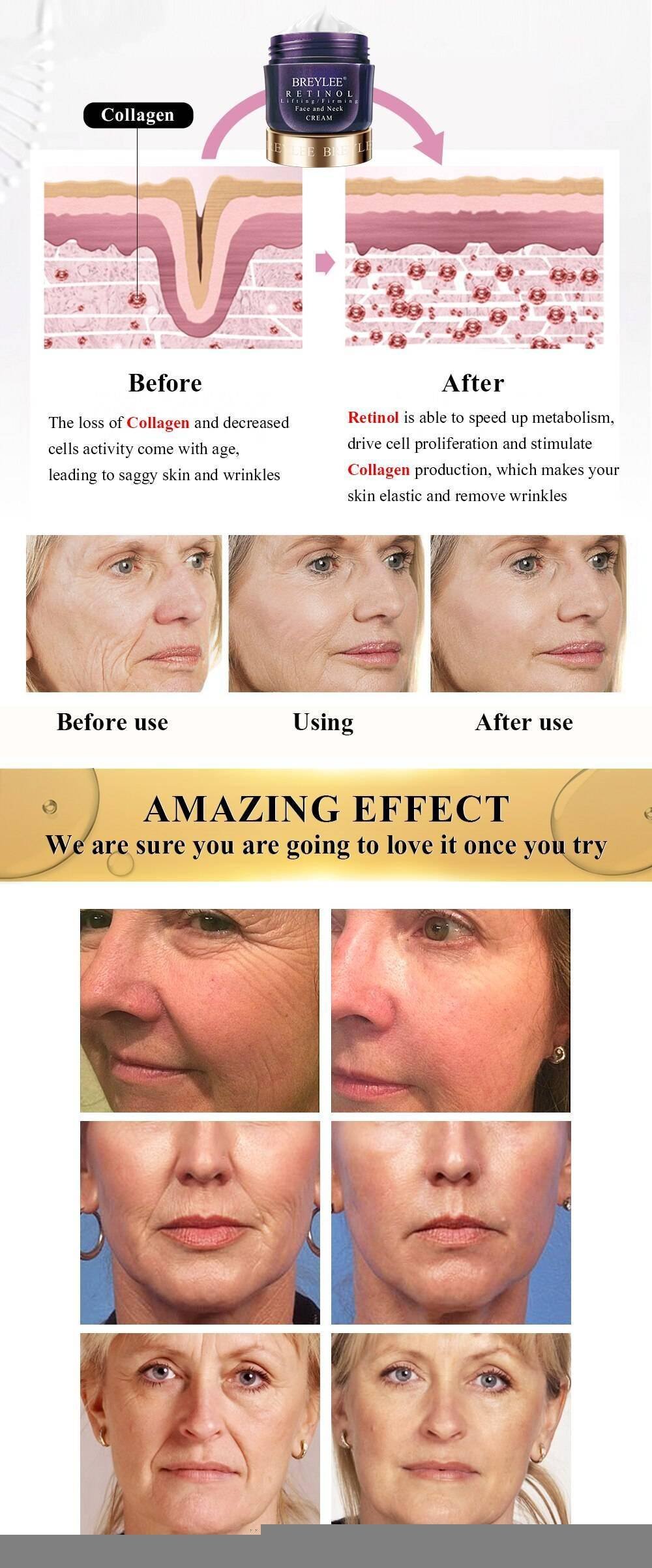 BREYLEE Retinol Firming Face Cream Lifting Firming Anti-Aging Remove Wrinkle Night Day Cream Moisturizing Facial Cream Skin Care