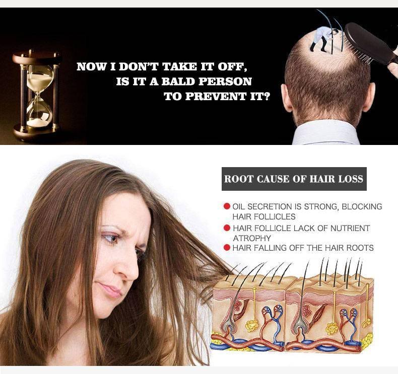 Fast Powerful Hair Growth Essence Hair Loss Products Essential Oil Liquid Treatment Preventing Hair Loss Hair Care Products 30ml