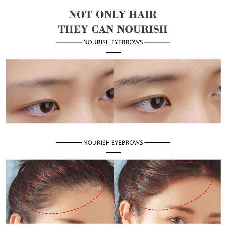 Fast Powerful Hair Growth Essence Hair Loss Products Essential Oil Liquid Treatment Preventing Hair Loss Hair Care Products 30ml