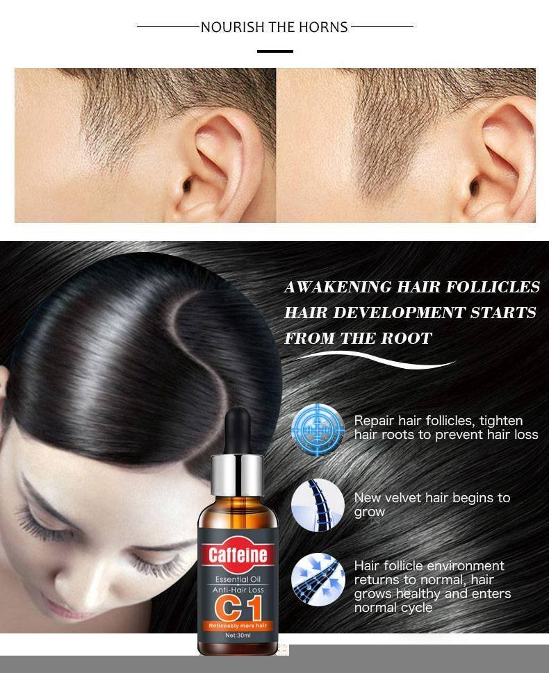 Fast Powerful Hair Growth Essence Hair Loss Products Essential Oil Liquid Treatment Preventing Hair Loss Hair Care Products 30ml