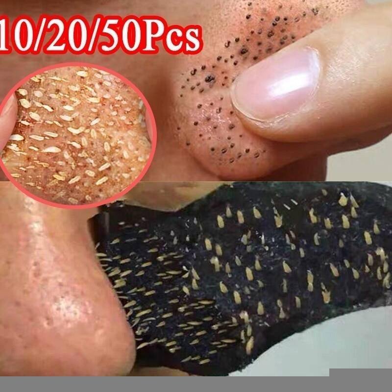 50pc Bamboo Charcoal Blackhead Remover Mask Black Dots Spots Acne Treatment Mask Nose Sticker Cleaner Nose Pore Deep Clean Strip Accessories Beauty & Health BEAUTY AND HEALTH 50pc Bamboo Charcoal Blackhead Remover Mask Black Dots Spots Acne Treatment Mask Nose Sticker Cleaner Nose Pore Deep Clean Strip Accessories Beauty & Health BEAUTY AND HEALTH http://gotoptrend.com/50pc-bamboo-charcoal-blackhead-remover-mask-black-dots-spots-acne-treatment-mask-nose-sticker-cleaner-nose-pore-deep-clean-strip/ http://gotoptrend.com Go Top Trend