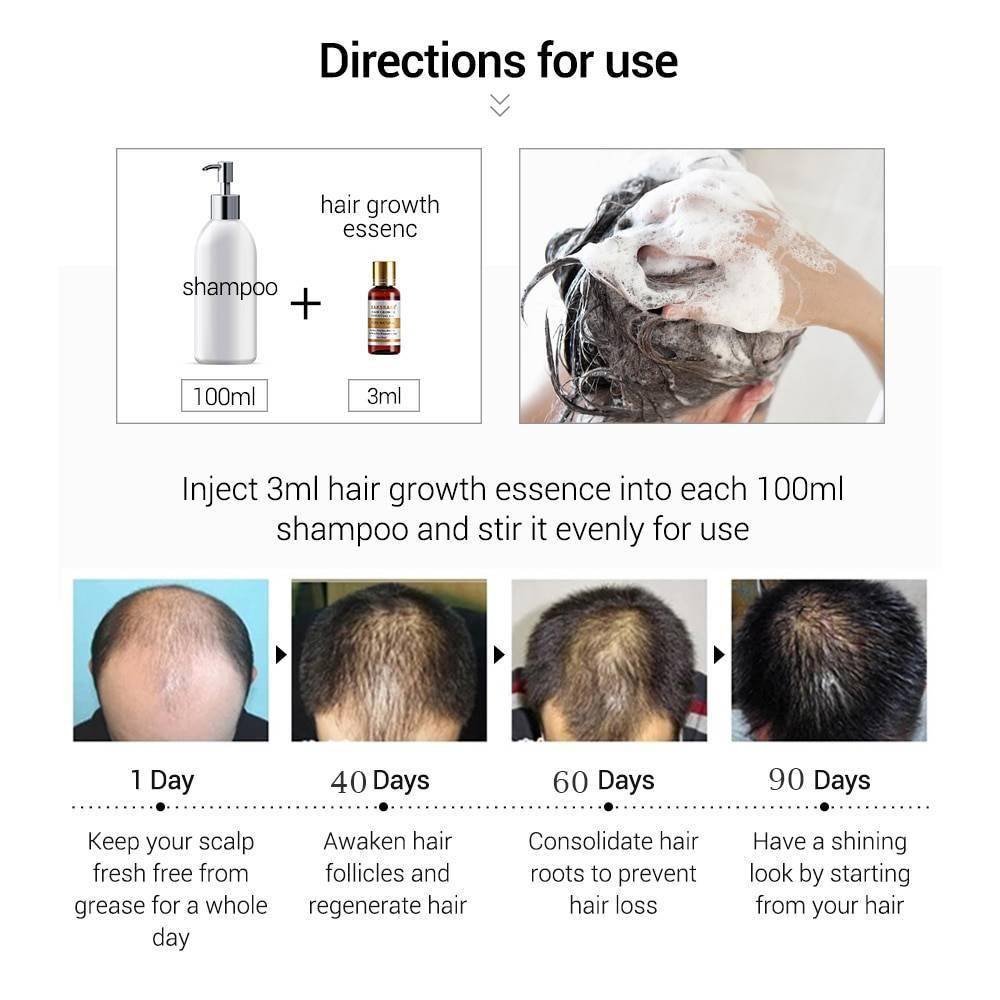 Hair Care Hair Growth Essential Oils Essence Original Authentic 100% Hair Loss Liquid Health Care Beauty Dense Hair Growth Serum BEAUTY AND HEALTH Best Sellers Hair Care Hair Growth Essential Oils Essence Original Authentic 100% Hair Loss Liquid Health Care Beauty Dense Hair Growth Serum BEAUTY AND HEALTH Best Sellers http://gotoptrend.com/hair-care-hair-growth-essential-oils-essence-original-authentic-100-hair-loss-liquid-health-care-beauty-dense-hair-growth-serum/ http://gotoptrend.com Go Top Trend