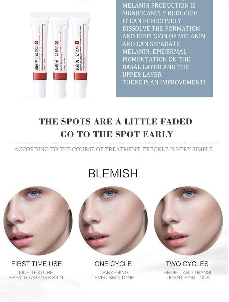 Effective Whitening Freckle Cream Remove Melasma Acne Spot Pigment Melanin Dark Spots Pigmentation Moisturizing Gel Skin Care
