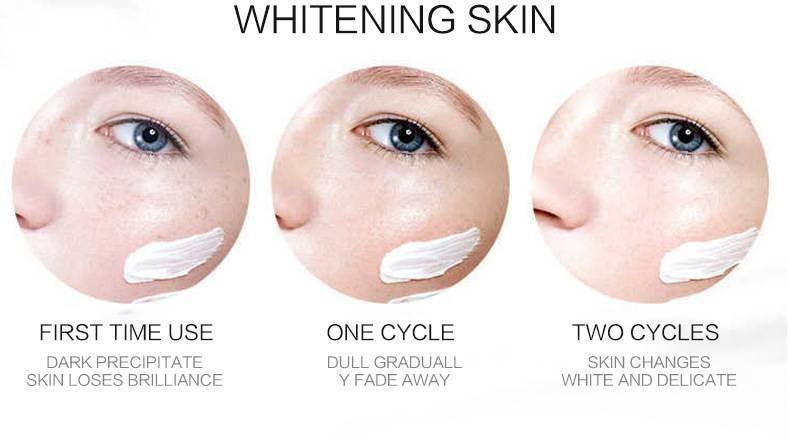 Effective Whitening Freckle Cream Remove Melasma Acne Spot Pigment Melanin Dark Spots Pigmentation Moisturizing Gel Skin Care