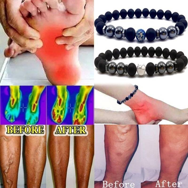 Magnet Anklet Colorful Stone eight Loss Magnetic Therapy Bracelet Weight Loss Product Slimming Health Care jewelry